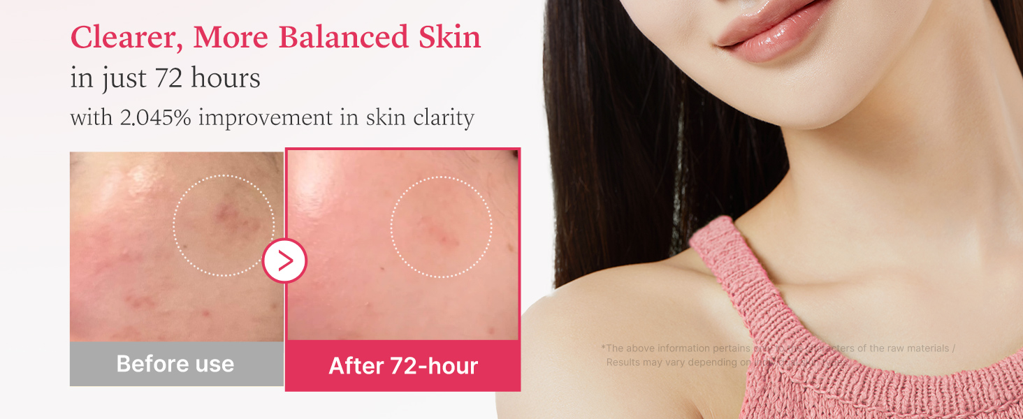 TXA Niacinamide 15_ Serum 30ml2